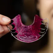 Hawley Retainers